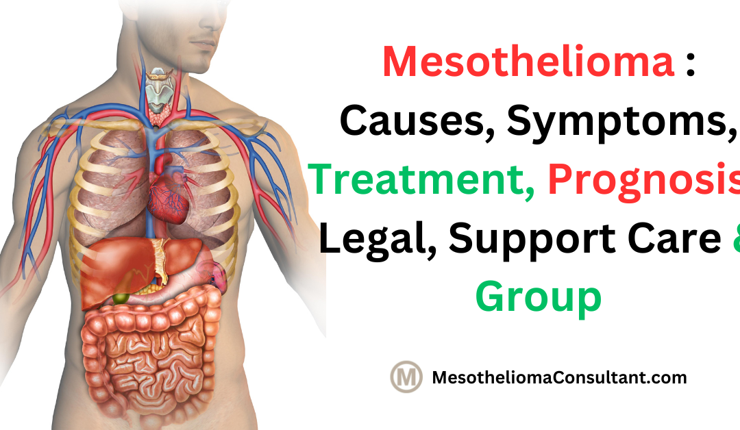 https://mesotheliomaconsultant.com/wp-content/uploads/2023/11/Mesothelioma-Causes-Symptoms-Treatment-Prognosis-Legal-Support-Care-Group-1080x628.png